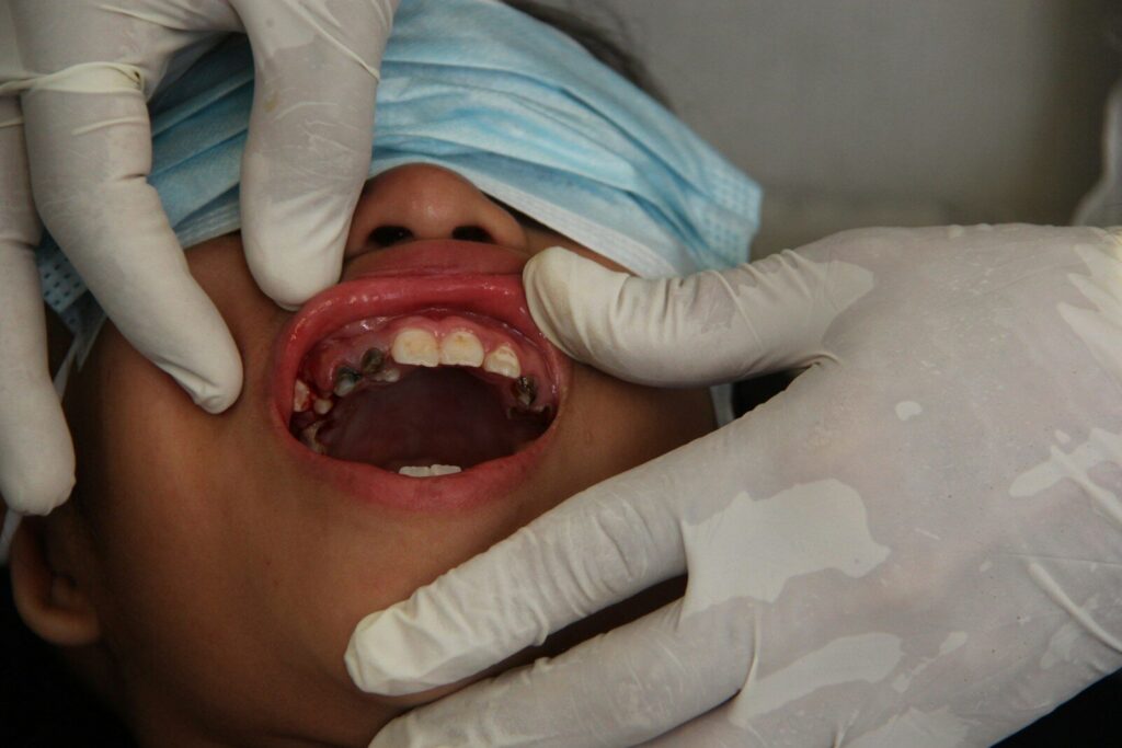 toothache